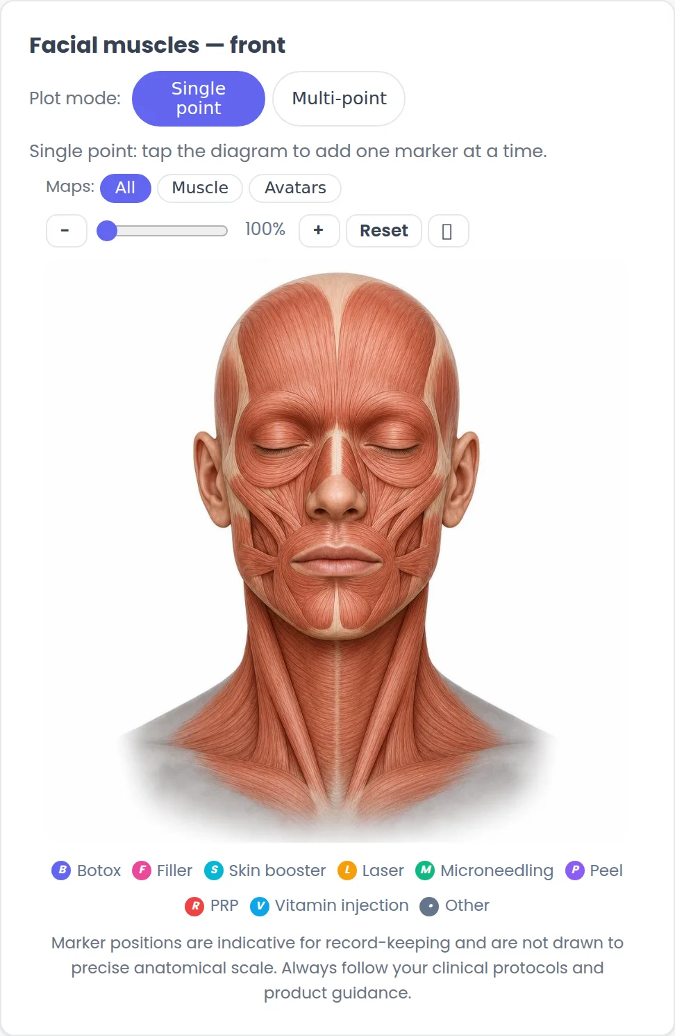 Orbis Salon facial muscle body map, front view, with plot modes, zoom controls and treatment-type legend